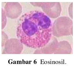 Gambar 6  Eosinosil. 