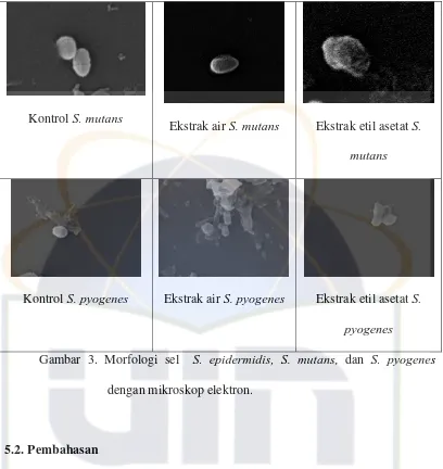 Gambar 3. Morfologi sel  S. epidermidis, S. mutans, dan S. pyogenes 