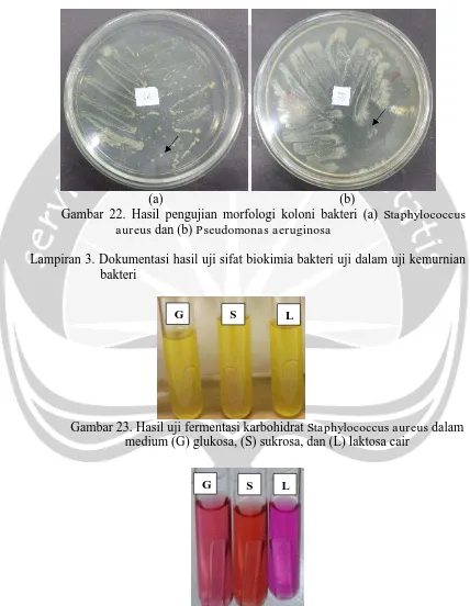 Gambar 22. Hasil pengujian morfologi koloni bakteri (a) aureus dan (b) Pseudomonas aeruginosa 
