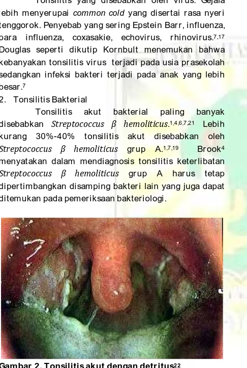 Gambar 2. Tonsilitis akut dengan detritus22 