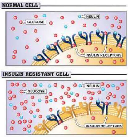 Gambar 1. Glukosa dalam Sel Normal dan dalam Sel Restisten Insulin 