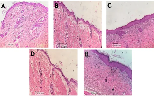 Figure 2. Histological picture on day 14 at 100x magnification, observed  under  a  light  microscope  (Olympus)  arrow  showing   Re-epithelialization:  (A)  KLEE  oint  3.25%;  (B)  KLEE  oint  6.5%;  (C)  KLEE  oint 13%; (D) Negative Control Group E) Po