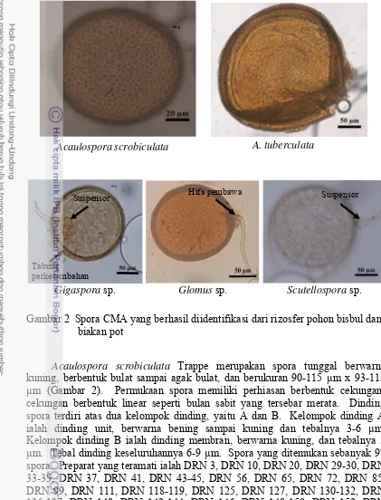 Gambar 2  Spora CMA yang berhasil diidentifikasi dari rizosfer pohon bisbul dan  