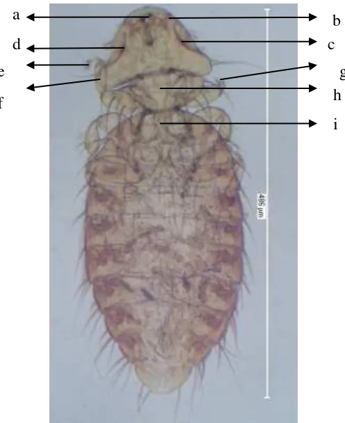 Gambar 3 Kutu ayam M. gallinae, (a) mandibula, (b) palpus maksila, (c) 