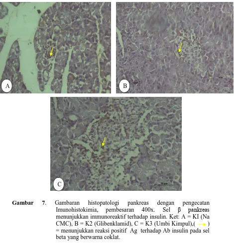 Gambaran histopatologi pankreas dengan pengecatan Imunohistokimia, pembesaran 400x. Sel β pankreas menunjukkan immunoreaktif terhadap insulin