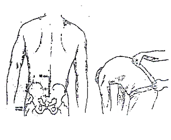 Gambar  4Schober test. Penderita berdiri (A), titik 0 yaitu bagian atas sacrum 