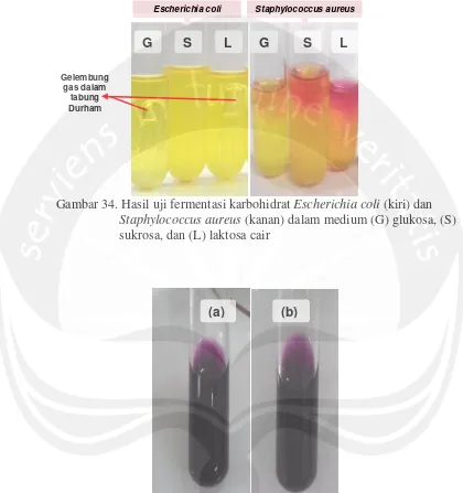 Gambar 34. Hasil uji fermentasi karbohidrat  Escherichia coli (kiri) dan  