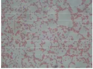 Gambar 2. Bakteri E.coli (dokumentasi laboratorium) 