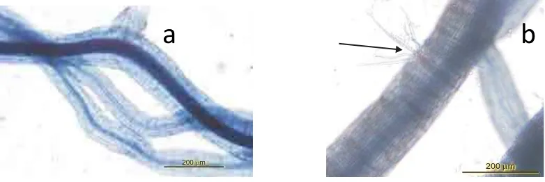 Gambar (Figure)1. Rambut akar cemara udang (a) tidak terinfeksi frankia dan (b) terinfeksi frankia(Roots hair ofvar.incana(a) uninfected by frankia and (b)infectedbyfrankia)Casuarina equisetifolia