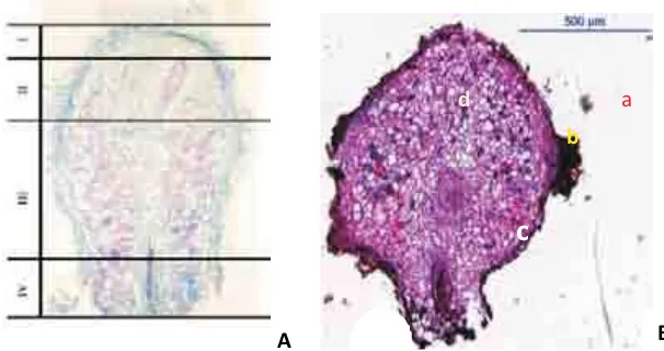 Gambar (Figure) 6. Sayatan bintil akar (A)(Obertelo., 2003) dan (B) Cemaraudang (var.incana)Casuarina glaucaet alCross section of the root nodule (A)Casuarina glaucaand (B)Casuarinaequisetifolia