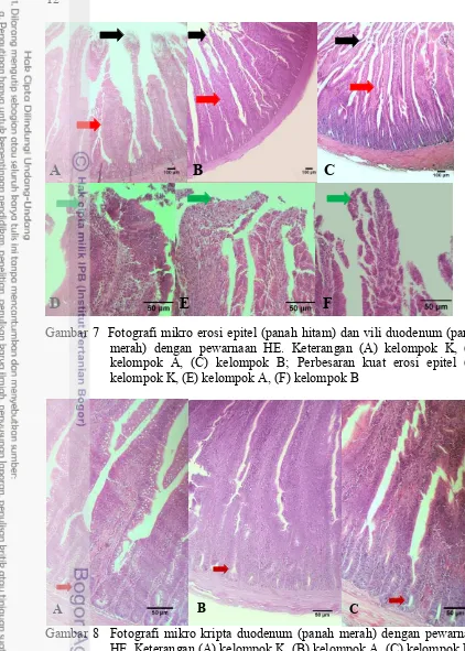 Gambar 7  Fotografi mikro erosi epitel (panah hitam) dan vili duodenum (panah 