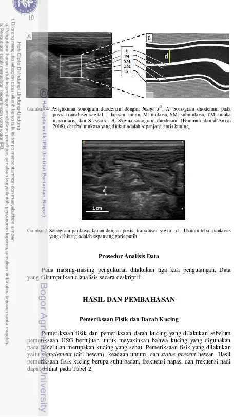 Gambar 4 Pengukuran sonogram duodenum dengan Image J®. A: Sonogram duodenum pada 