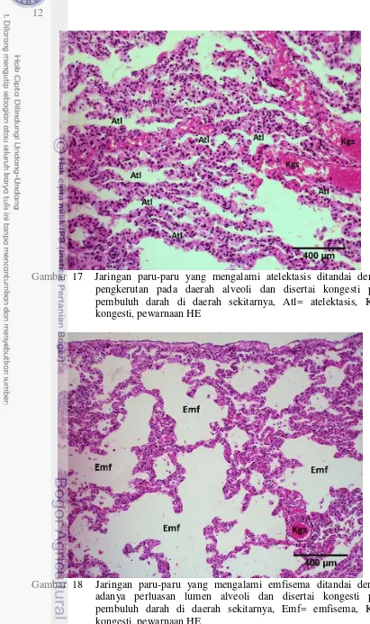 Gambar 18  Jaringan paru-paru yang mengalami emfisema ditandai dengan adanya perluasan lumen alveoli dan disertai kongesti pada pembuluh darah di daerah sekitarnya, Emf= emfisema, Kgs= kongesti, pewarnaan HE 