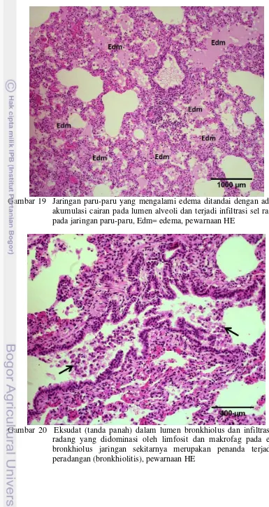 Gambar 20  Eksudat (tanda panah) dalam lumen bronkhiolus dan infiltrasi sel radang yang didominasi oleh limfosit dan makrofag pada epitel bronkhiolus jaringan sekitarnya merupakan penanda terjadinya peradangan (bronkhiolitis), pewarnaan HE 