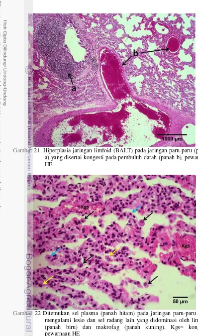 Gambar 22 Ditemukan sel plasma (panah hitam) pada jaringan paru-paru yang mengalami lesio dan sel radang lain yang didominasi oleh limfosit (panah biru) dan makrofag (panah kuning), Kgs= kongesti, pewarnaan HE 