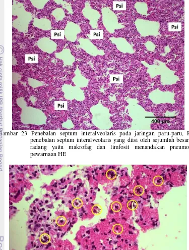 Gambar 24  Hemosiderin dan hemosiderofag/  heart failure cells (dalam lingkaran) 