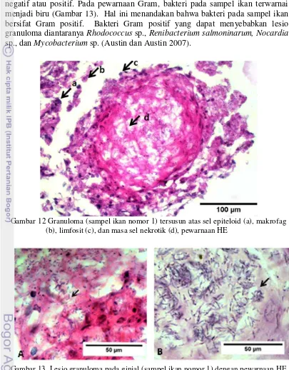 Gambar 13  Lesio granuloma pada ginjal (sampel ikan nomor 1) dengan pewarnaan HE 