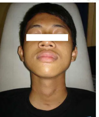 Gambar 7. Enam bulan setelah trauma 