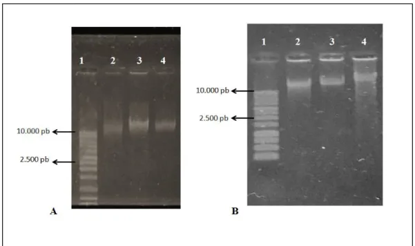 Gambar 3. Hasil elektroforesis DNA genom bakteri endofit dari daun salam dan daun  sirsak