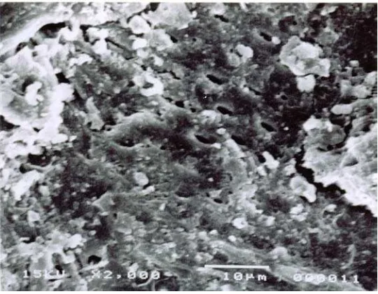 Gambar 1. Abu yang menutupi permukaan arang aktif, diamati dan diukur dengan                          mikroskop elektron  