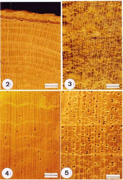 Gambar (Figure) 2-7 : Penampang lintang (cross section of) : 2) Eurycoma longifolia,  3) Strychnos ligustrinum, 4) Samadera indica
