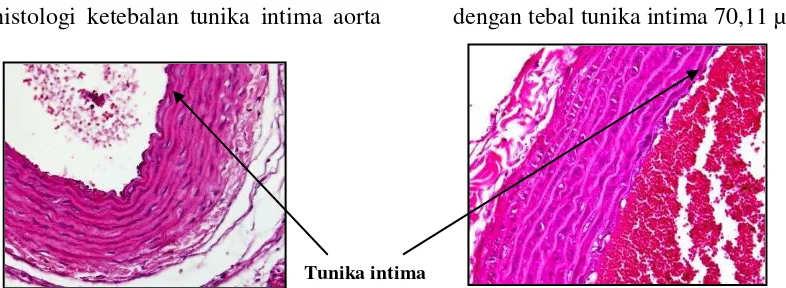 Gambar 1. Aorta tikus  kelompok kontrol negatif  dan kelompok  perlakuan 1. 