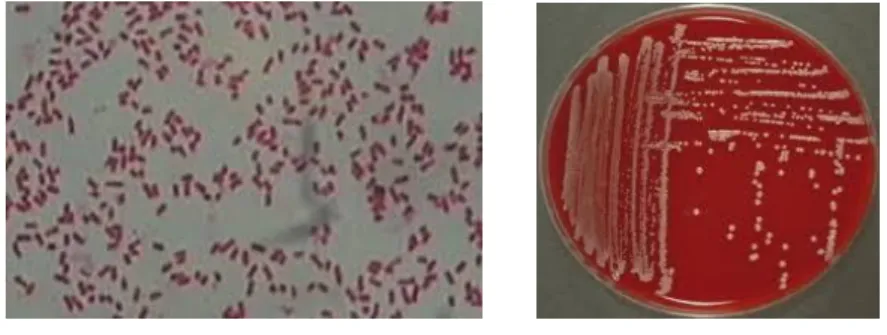 Gambar  2.1    :  Klebsiella  Pneumonia  (sumber  :  Sherris  Medical  Microbiology, 2014)