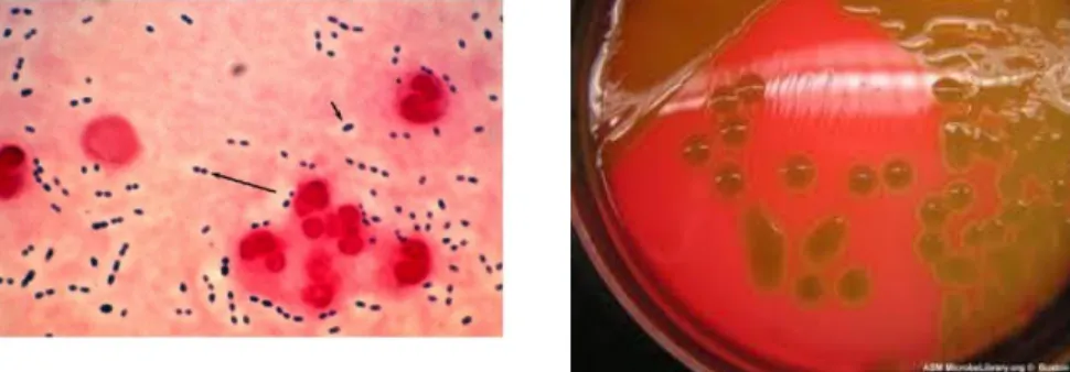 Gambar  2.2  :  Streptococcus  Pneumonia  (sumber  :  Sherris  Medical  Microbiology, 2014) 