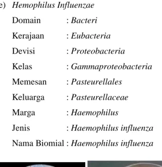Gambar 2.5 : Haemophylus Influenza (sumber : Sherris Medical  Microbiologi, 2014) 