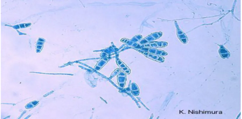 Gambar 2. Morfologi mikroskopis K. Nishimura (2010) 