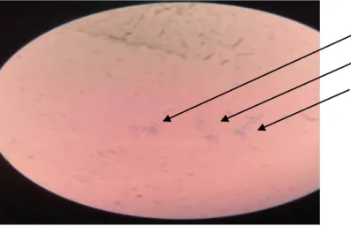 Gambar 7. Pemeriksaan jamur penyebab Tinea pedis dibawah mikroskop  Gambar  diatas  merupakan  jamur  Tinea  pedis  yang  telah  di  tanam  di  media SDA kemudian di simpan di inkubator selama 48 jam pada suhu 37ºC  setelah  itu  di  lakukan    pewaranaan 