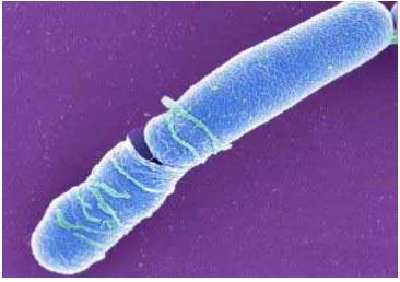 Gambar 2.6 Spora Bacillus cereus 