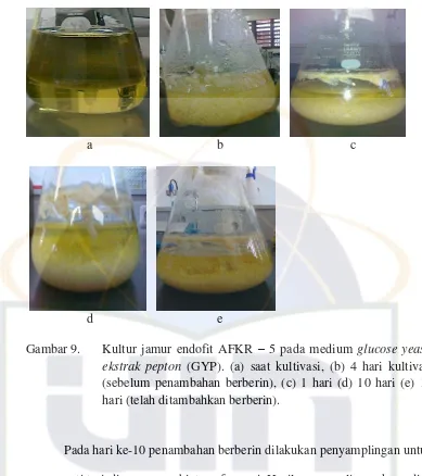 Gambar 9. Kultur jamur endofit AFKR – 5 pada medium glucose yeast-ekstrak pepton (GYP)