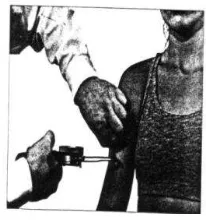 Gambar 5 : Biceps Skinfold 