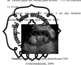 Gambar 5. Ginjal normal pada pemeriksaan USG 