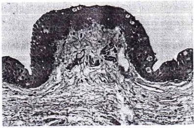 Gambar l: Cambaran mikroskopis epitelkotrjur,gtiva normal.