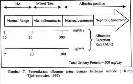 Gambar 7. Tjokroprawiro, Pemeriksaan ( albumin urine dengan berbagai metode Kutip1997)