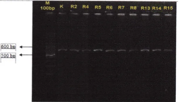 Gambar 1 : Eleknoforegram hasil Amplifikasi Fragmen DNA gen VGSC