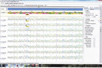 Gambar 3 : Hasil analisis data sekuensing adanya mutasi pad kodon Vl0l6G Ae. aegtpti