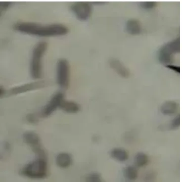 Gambar 5. Bentuk sel bakteri isolat MI2.3