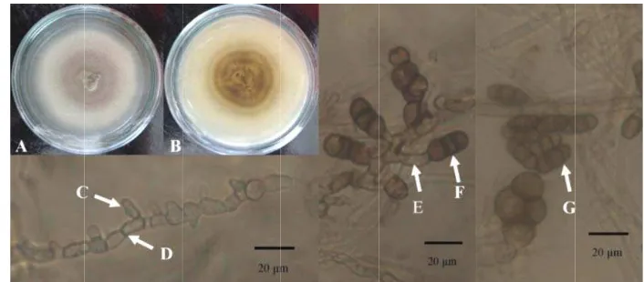 Gambar 1  MoGba10orfologi Rhizopawah, (C) penju000×. Skala barpycnis sp.1 (isouluran hifa, (Dr 20 µm. olat JBba3): (AD) hifa septat, (A) koloni tamp(E) konidioforpak atas, (B) k, (F-G) konidiakoloni tampak a