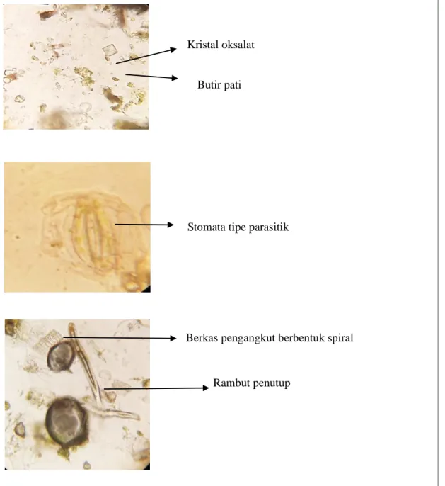 Gambar 5. Mikroskopik serbuk simplisia herba nanas kerang 