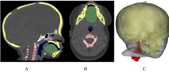 Figure 7. Visualization of segmentation with various anatomic regions for designing the difficult  tracheal intubation phantom in CT images of an 18-month-old patient with Crouzon syndrome
