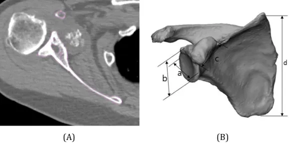 Figure 15. Visualization of segmented anatomies and the modeled scapular phantom in CT images  of  a  76-year-old  patient  with  reverse  total  shoulder  arthroplasty  (RTSA)