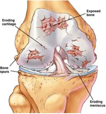 Fig. 1-3 OA knee anatomy structure   