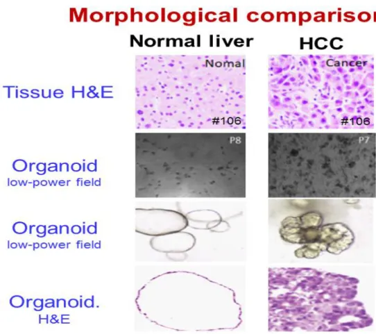 Figure 7. 정상 간 조직 및 간세포암 오가노이드 형태학적 비교