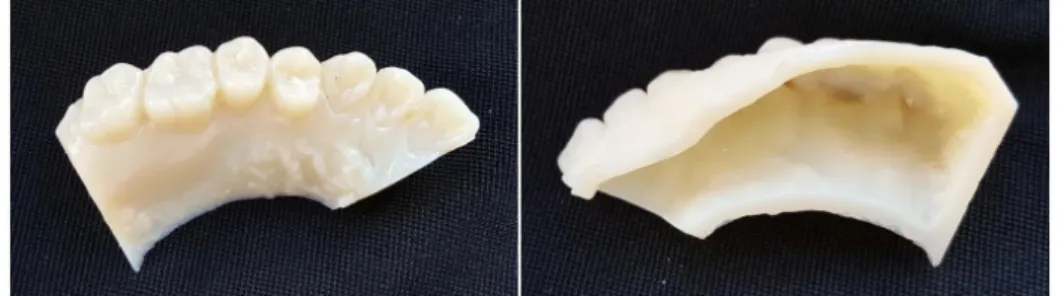 Fig  4.  Maxillary  right  experimental  model  was  fabricated  by  Polyjet  3-dimensional  printer.