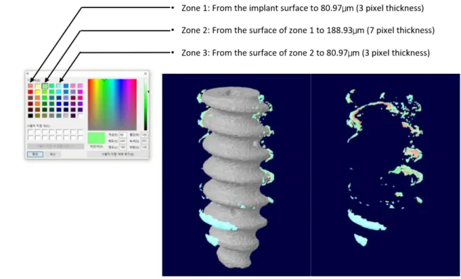 Figure 3. Bone implant contact (BIC) measurement section selection. 