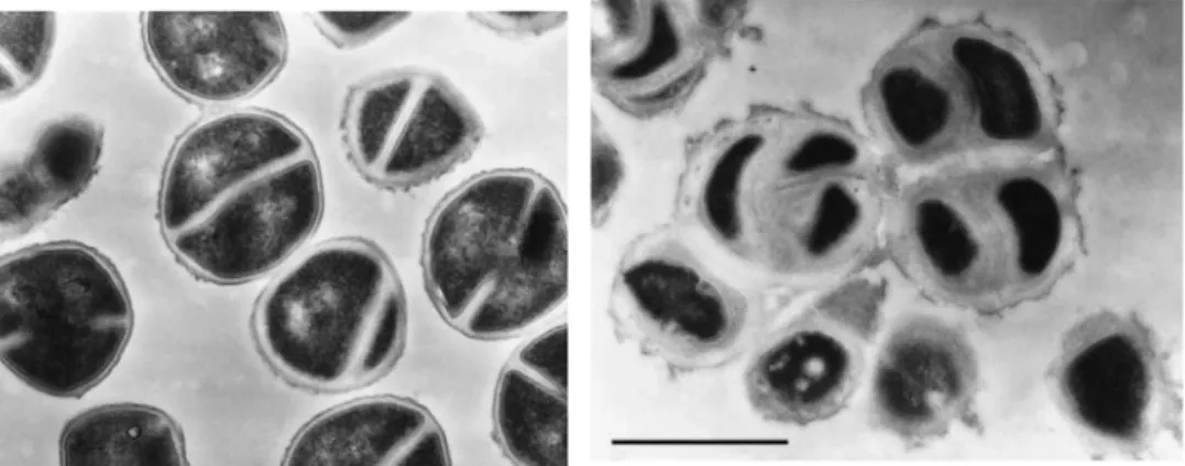 그림 2. 반코마이신 중등도내성 황색포도알균(PC-3)의 형태적 이상 (투과전자현미경, 줄 길 이 1  μ m)[13]