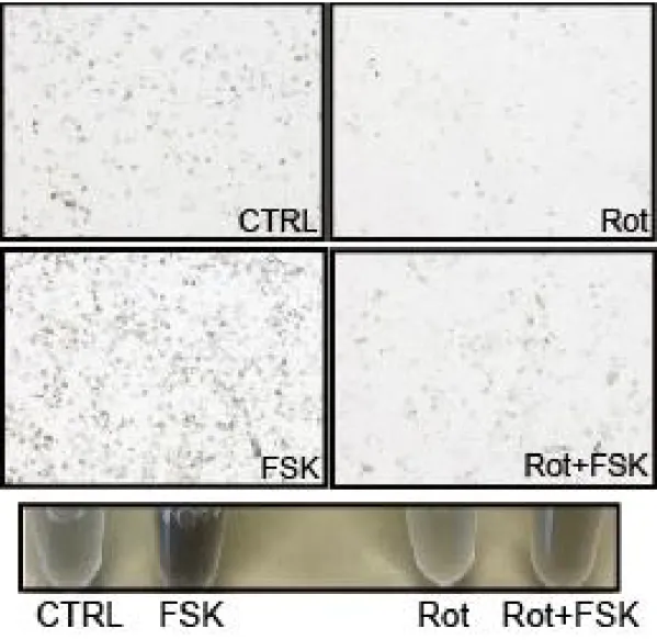그림 4-1. Mel-ab  세포에서 forskolin과 rottlerin에 따른 멜라닌 함량의 현미 경 관찰